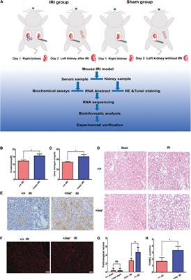 Transcriptomic Analysis Revealed an Important Role of Peroxisome-Proliferator-Activated Receptor Alpha Signaling in Src Homology Region 2 Domain-Containing Phosphatase-1 Insufficiency Leading to the Development of Renal Ischemia-Reperfusion Injury